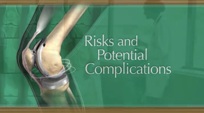 Risks and Potential Complications of Knee Replacement