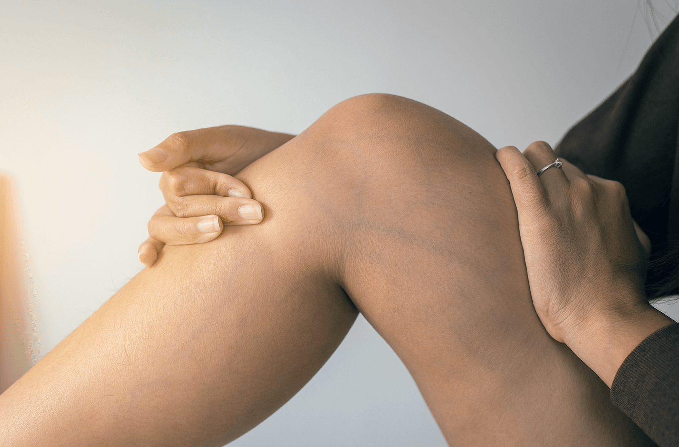 Image of Vein and Vascular Center