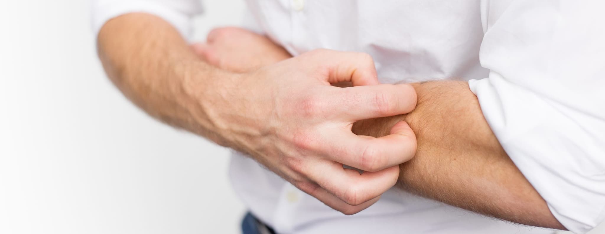 Picture of man scratching arm