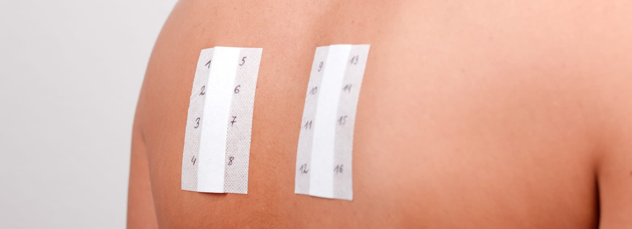 Picture of Immunotherapy back treatment