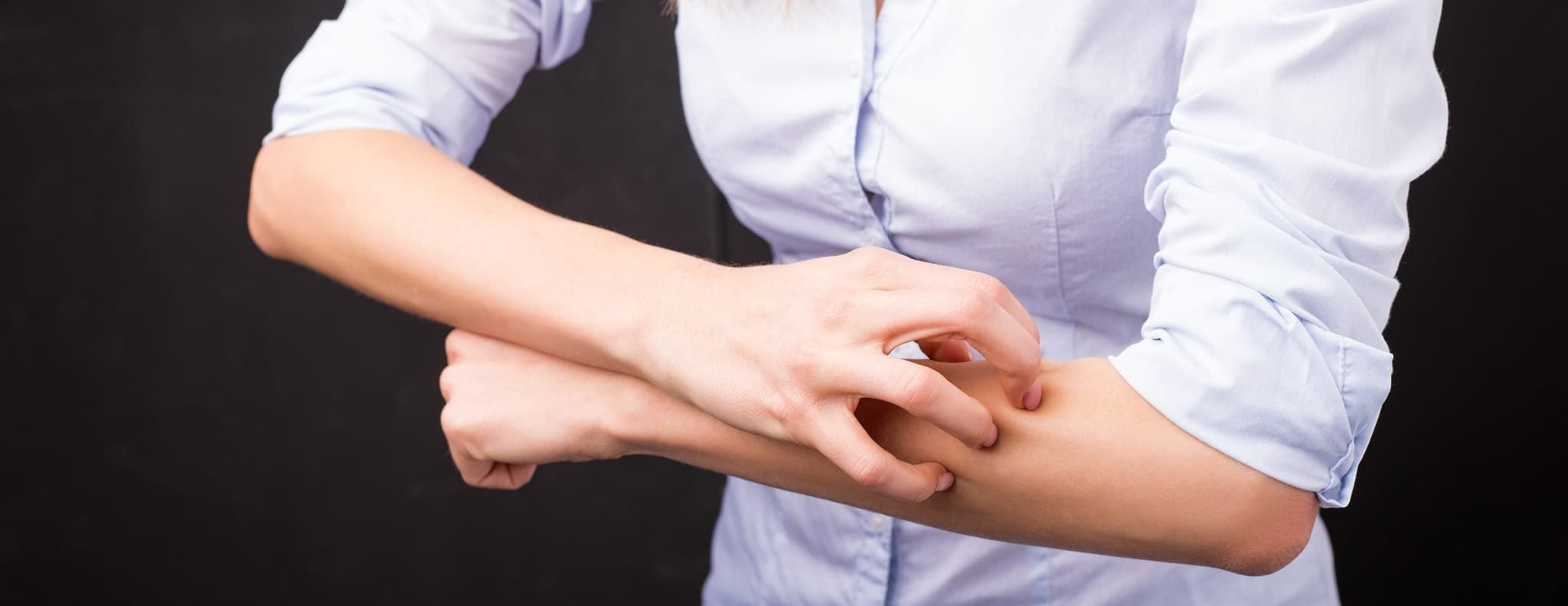 woman scratching arm - Recognize and Treat Hives