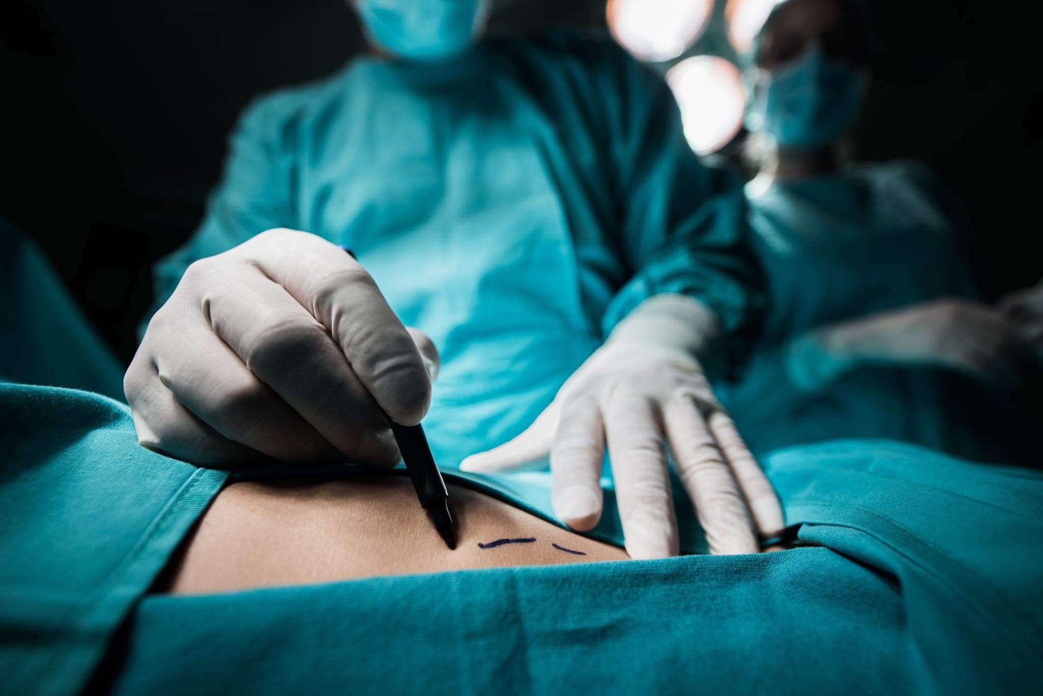 Picture of Close up of a plastic surgeon marking the human skin for surgery.