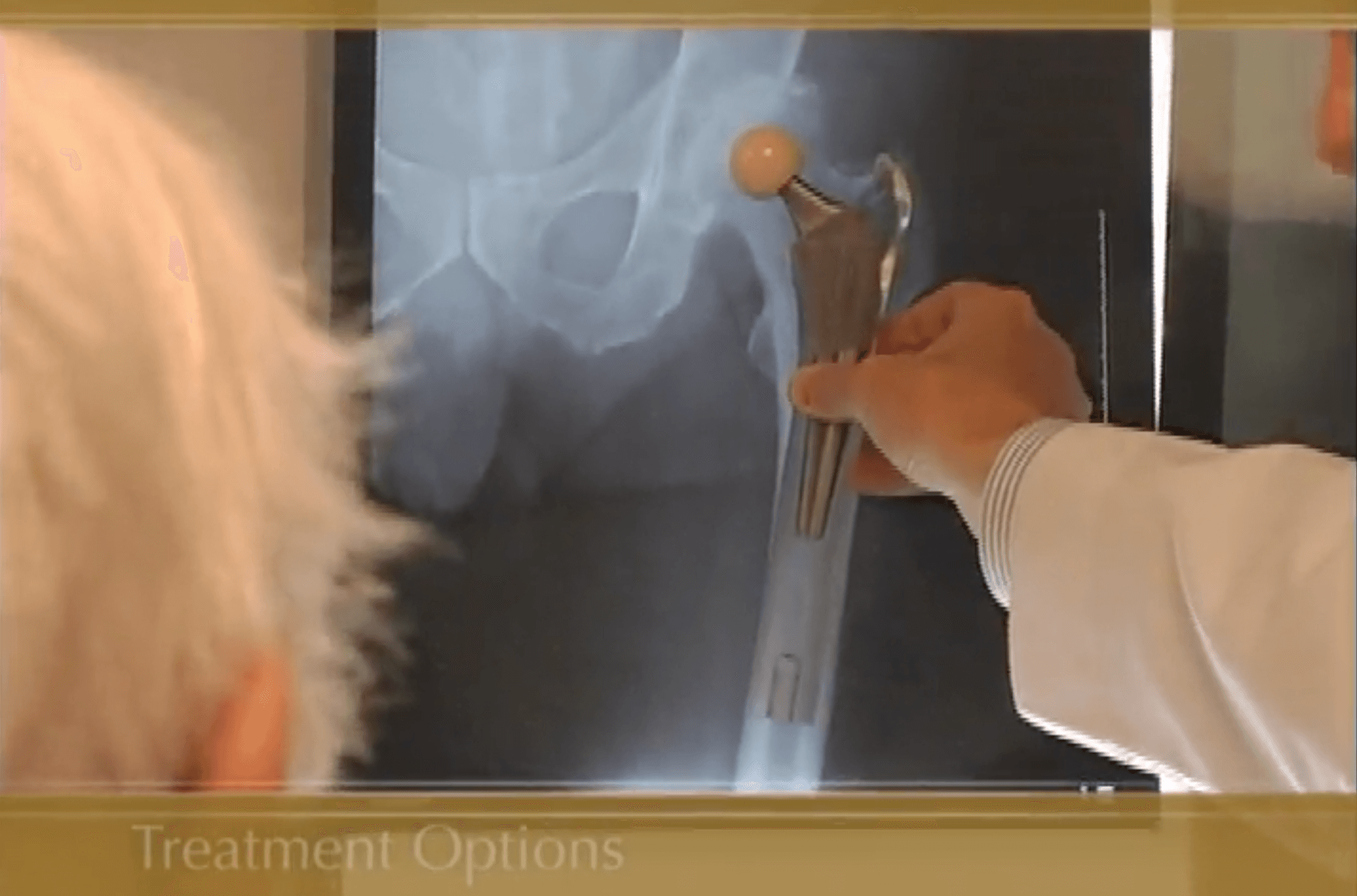 Hip Treatment Options