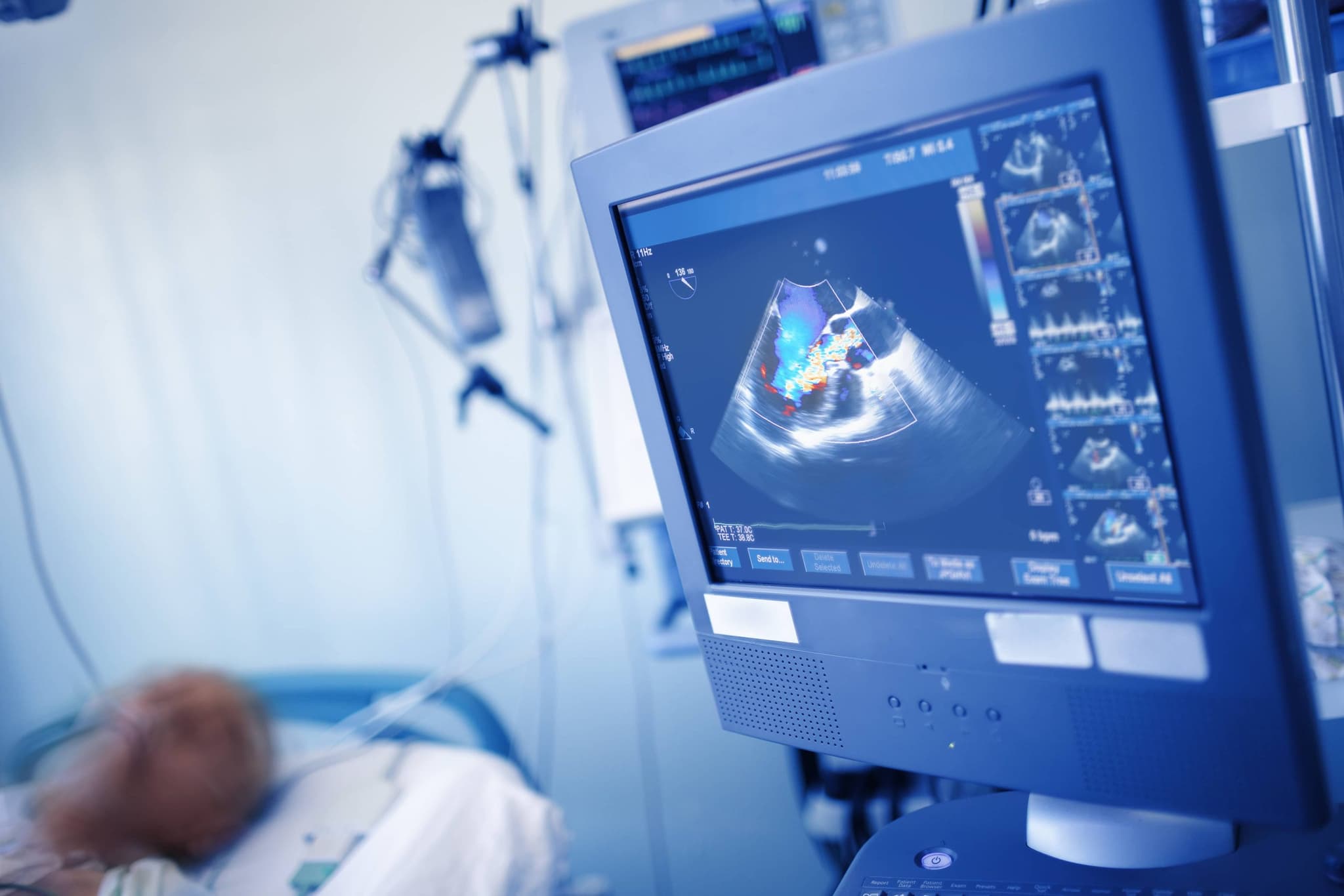 Revere Health Echocardiology providers are committed to using the latest techniques and technologies to diagnose heart conditions.