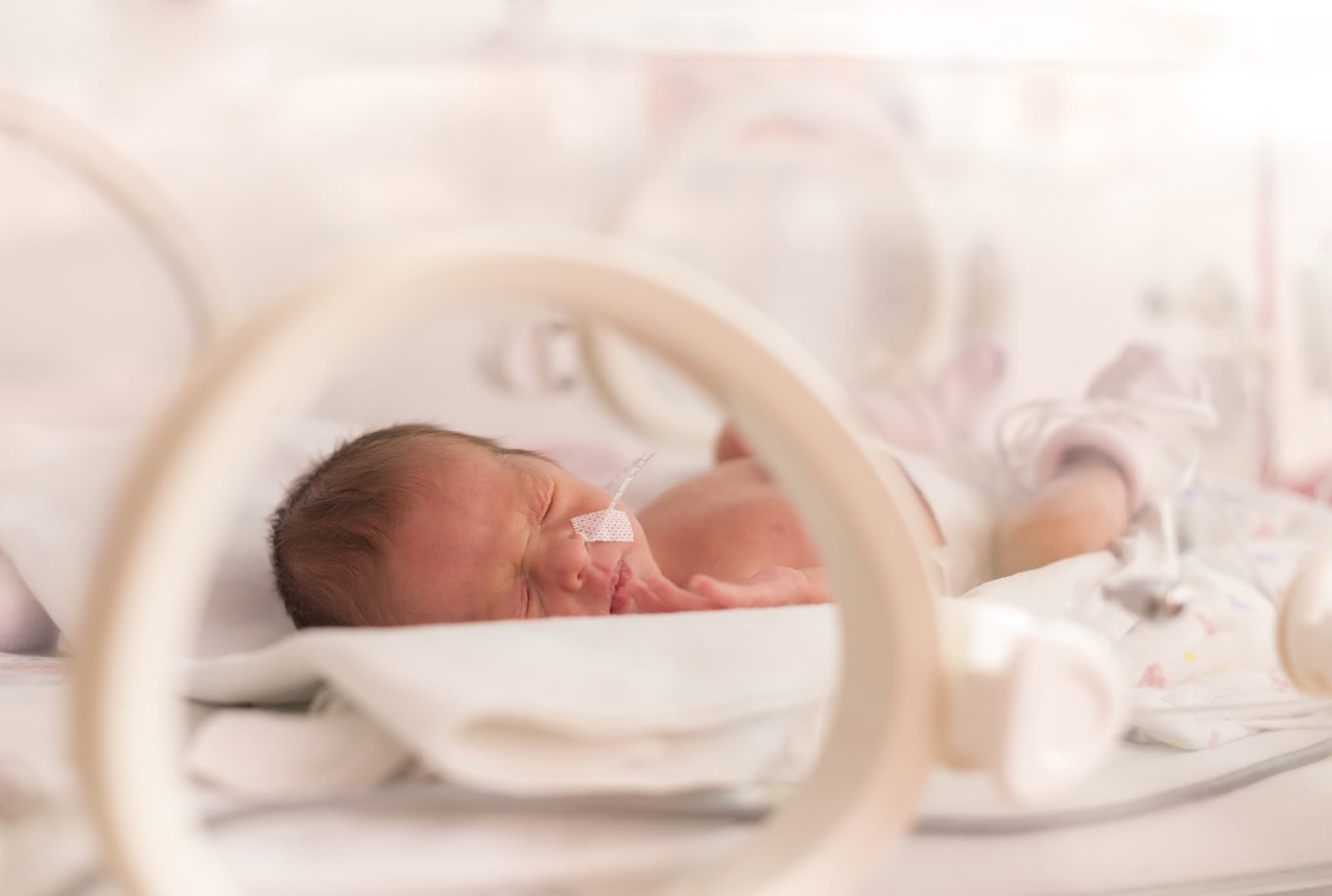 Premature newborn baby girl in the hospital incubator after c-section in 33 week