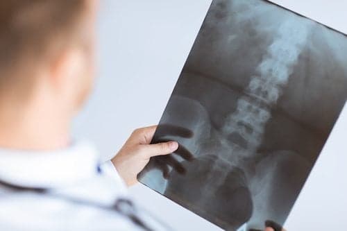 doctor holding x-ray or roentgen image