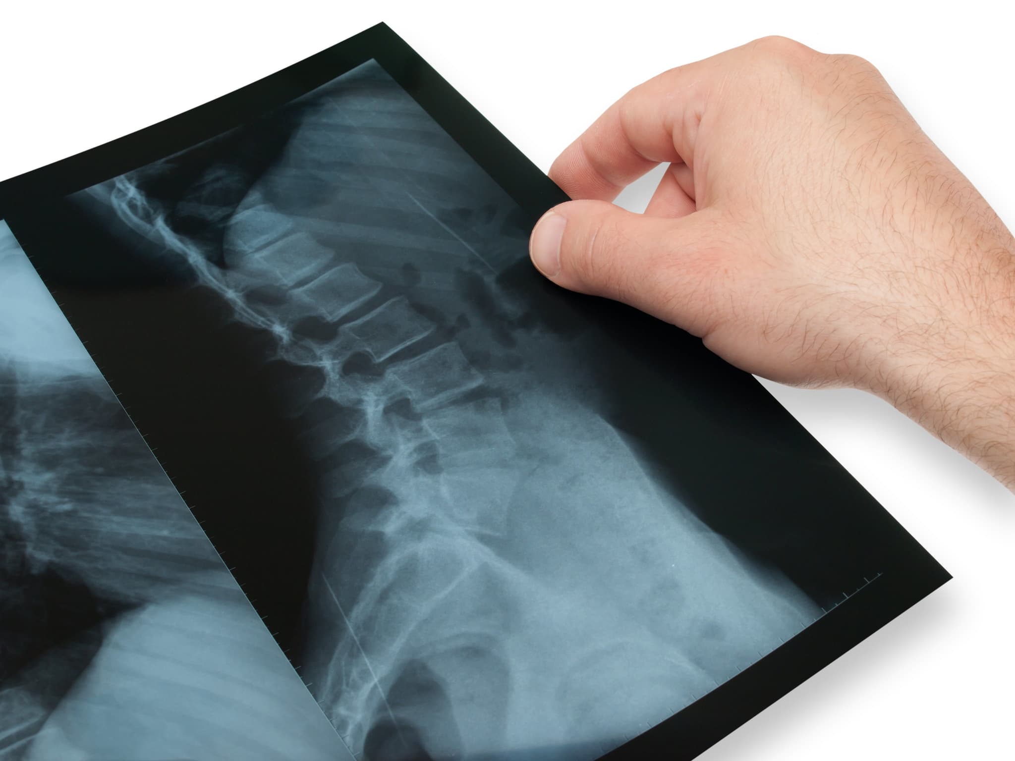 X- ray