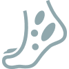 Icon of Hives and/or Swelling