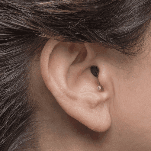 Audiology phonak