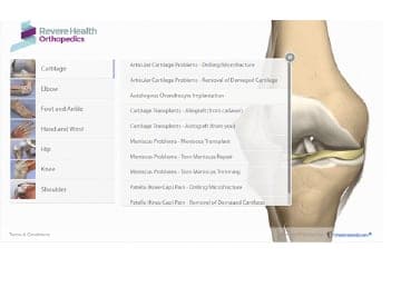 Orthopedic Interactive Animation