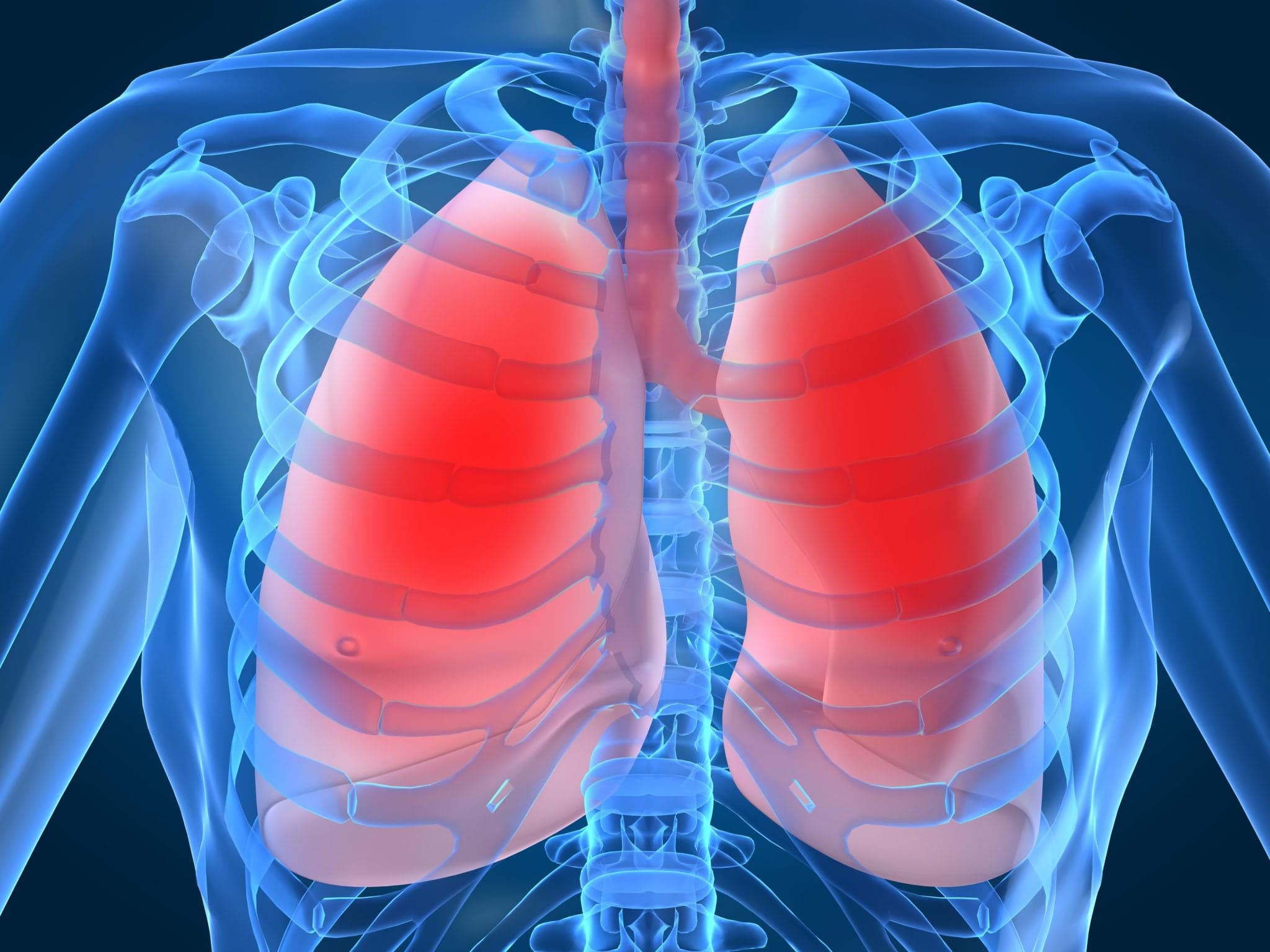 Diagram showing inflamed or infected lungs