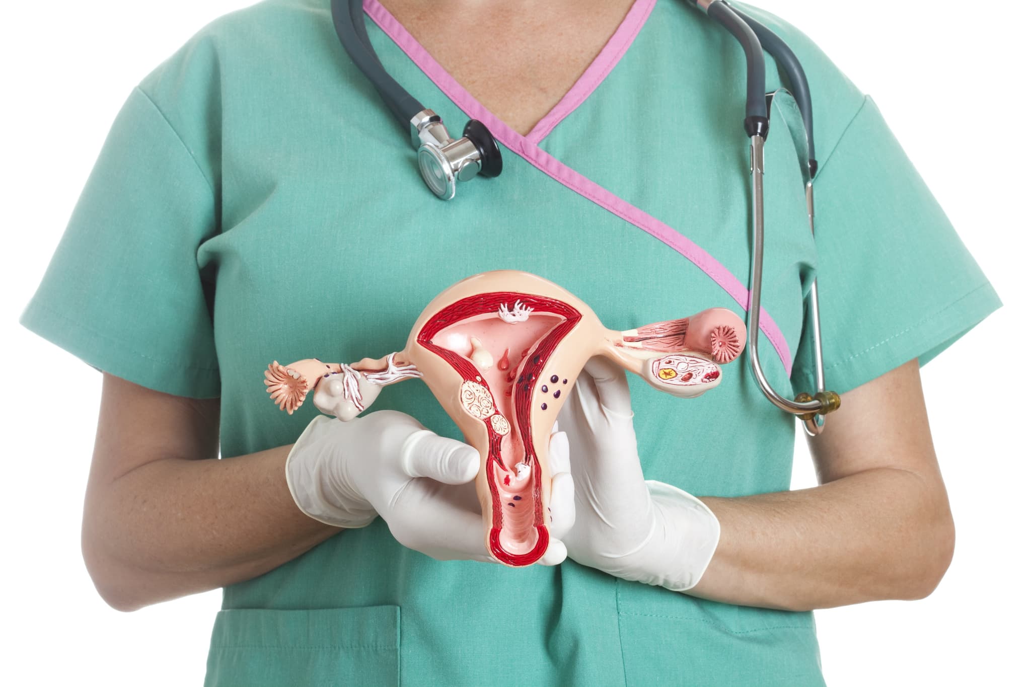 Picture of doctor holding Uterus and ovaries model