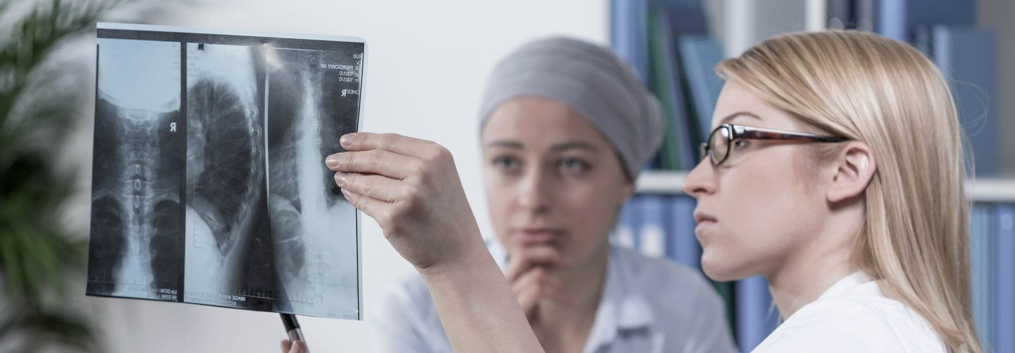 Picture of Female physician and her patient checking xray photo