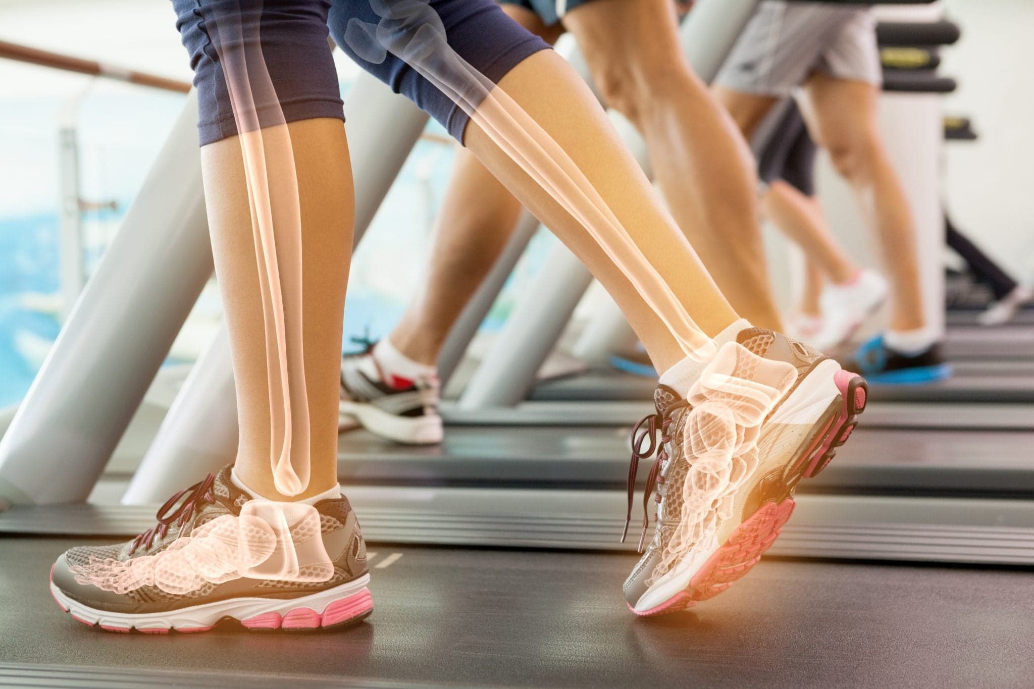 Highlighted ankle of woman on treadmill