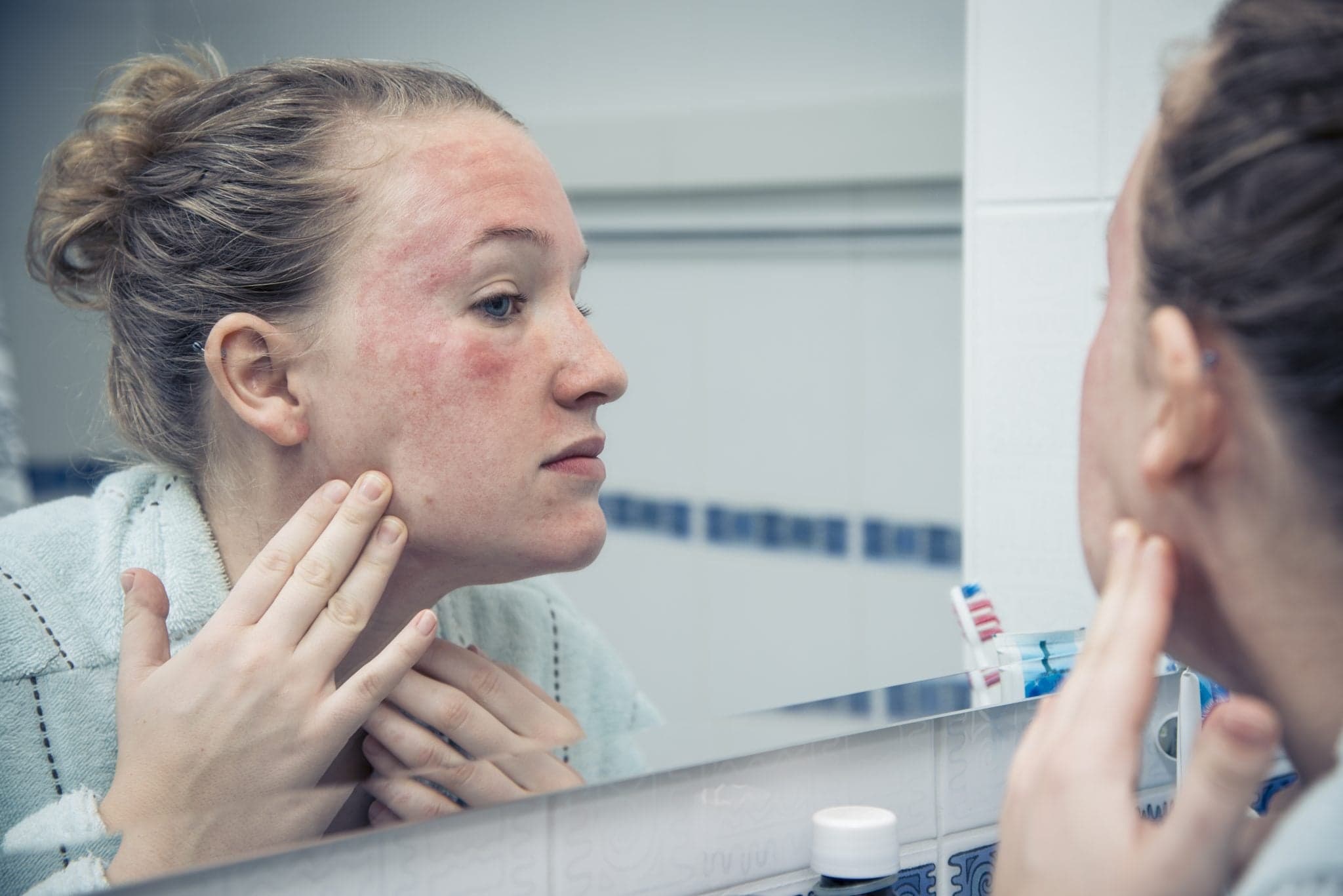 Picture of Woman with allergic reaction looking herself in the mirror.