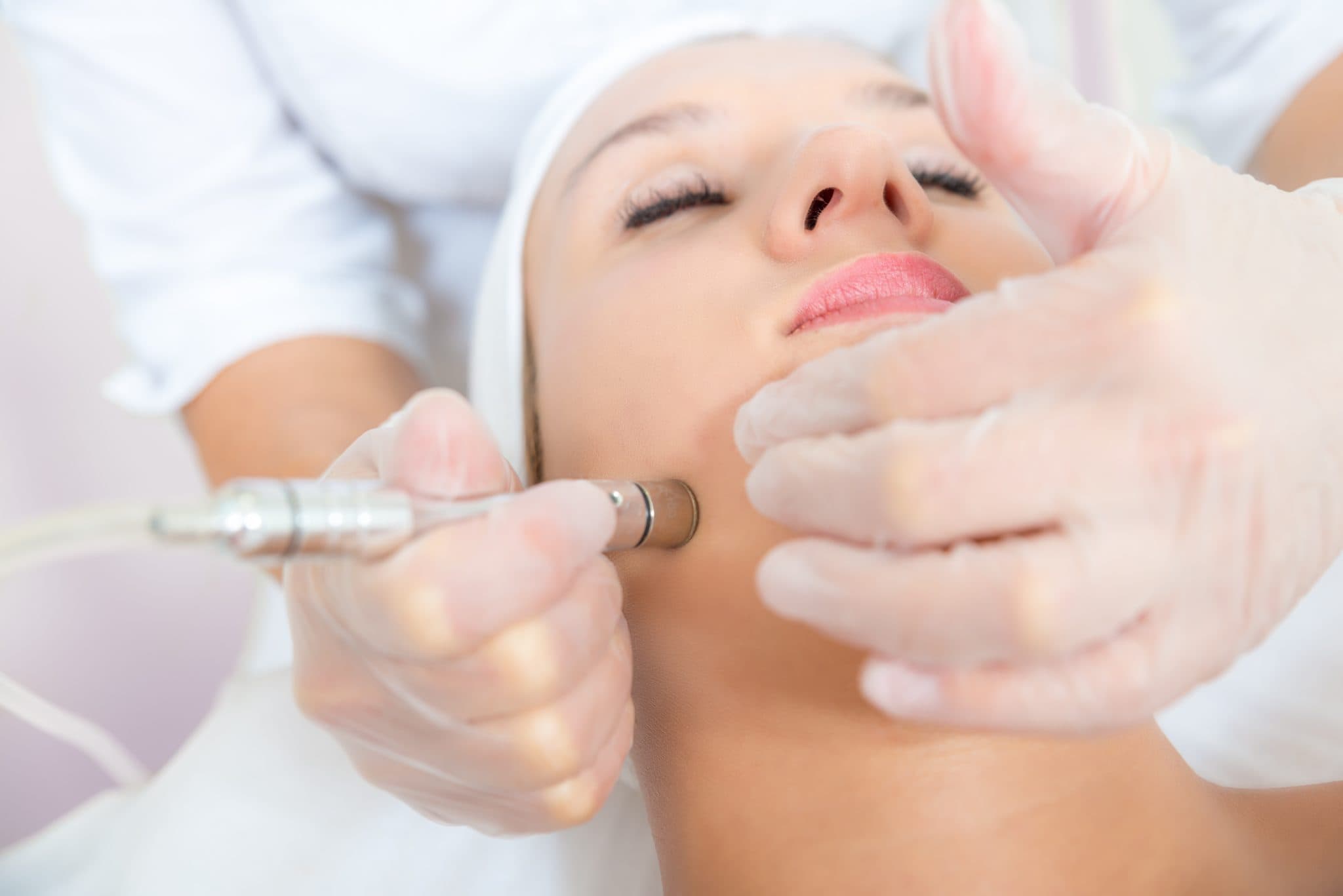 woman receiving Microdermabrasion treatment