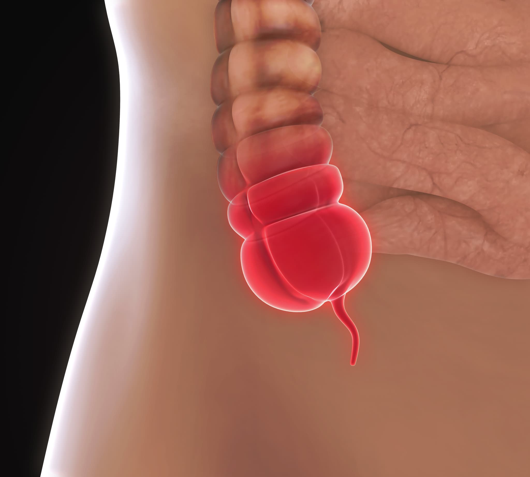 Appendix Pain Illustration. 3D render