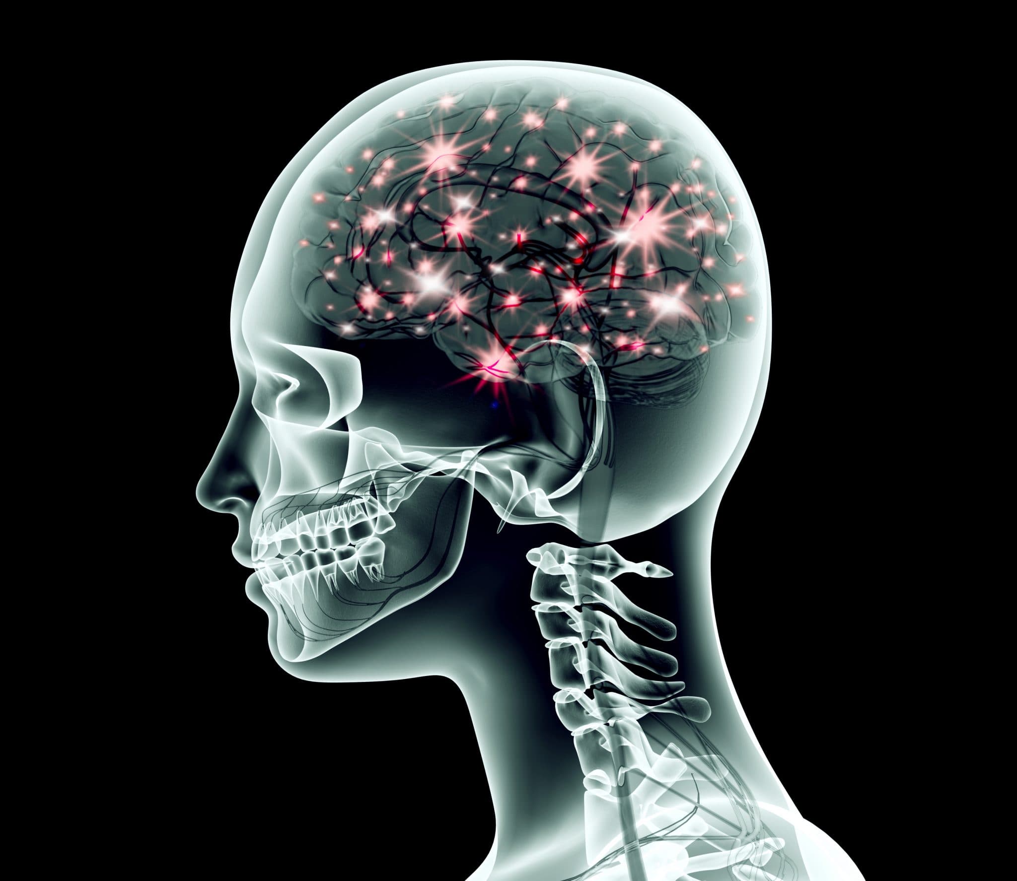 Picture of xray image of human head with brain and electric pulses