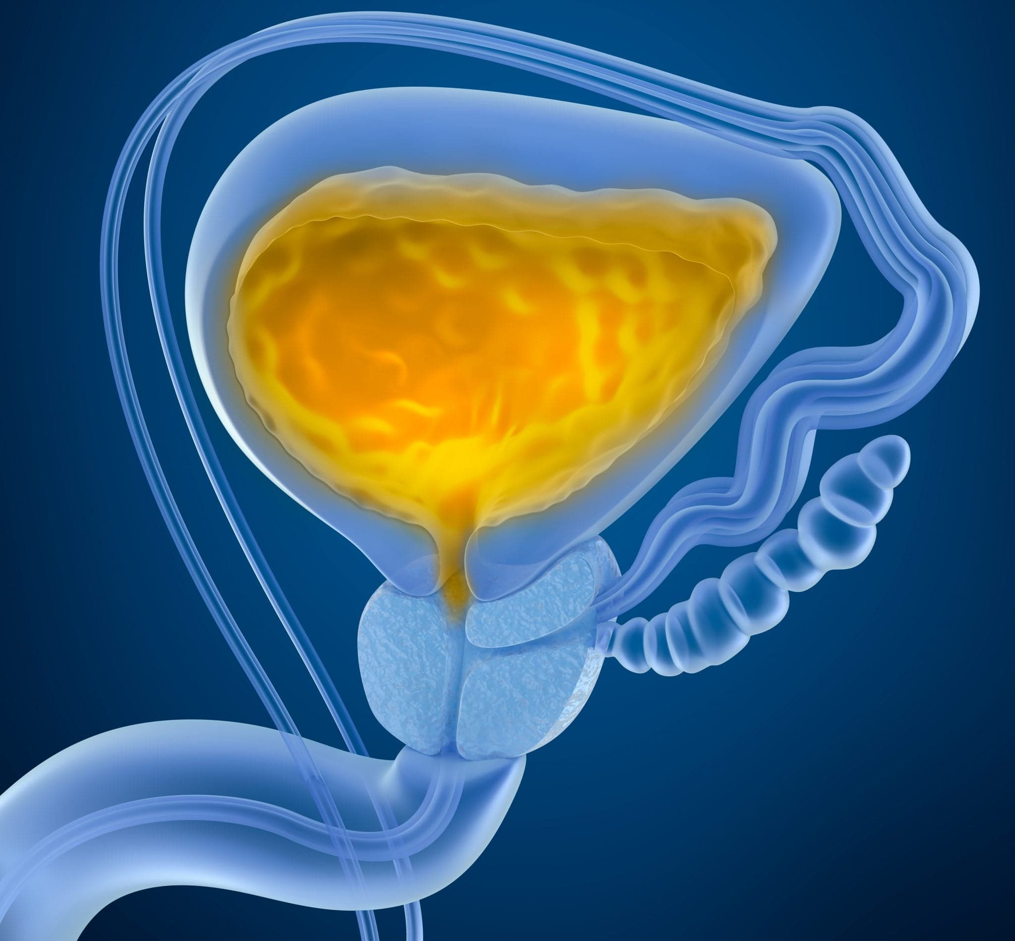 Picture of Urinary bladder with urine. Cross section of urinary bladder. X-Ray view