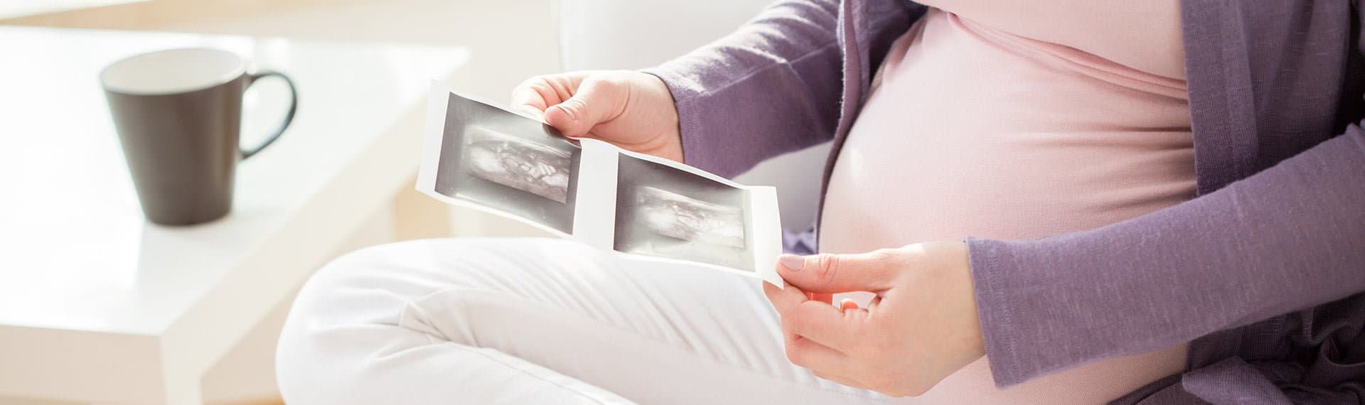 pregnant woman looking at ultra sound