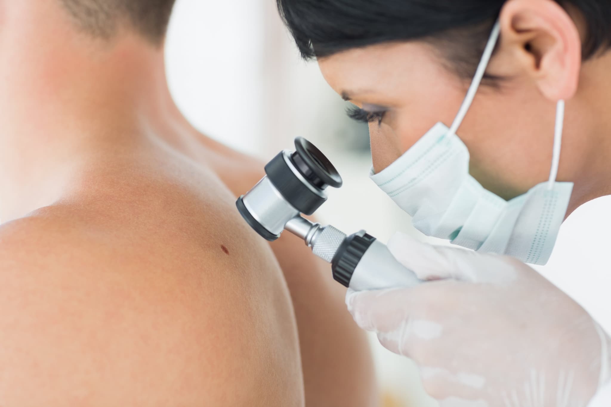 Image of Dermatologist examining mole on patient