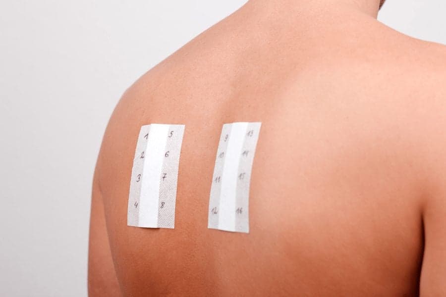 Picture of Immunotherapy back treatment