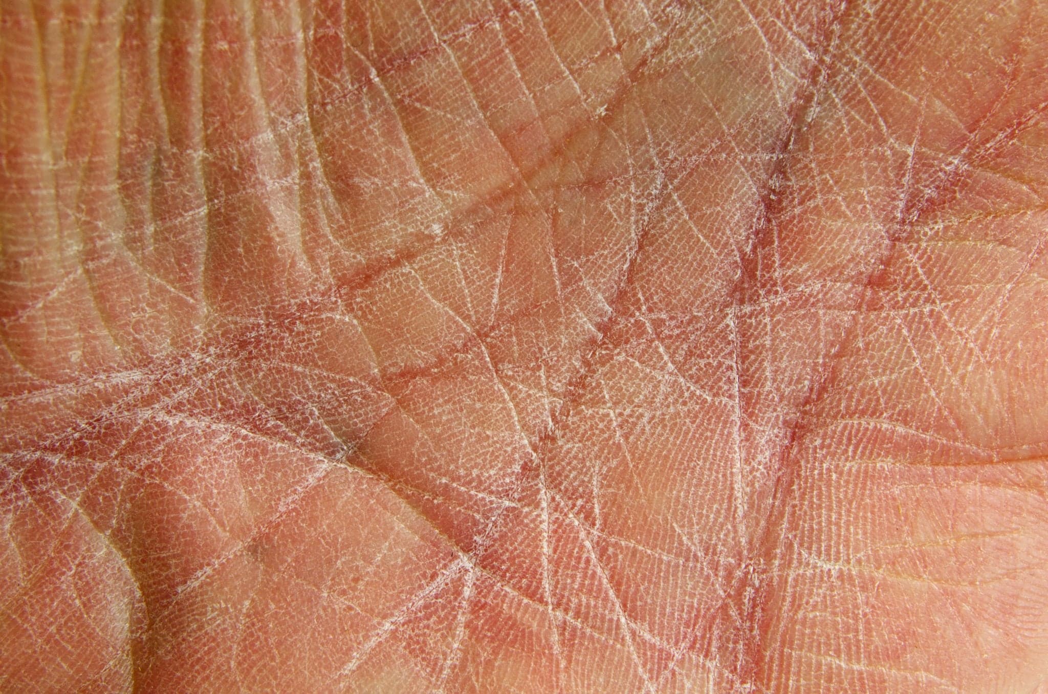 Picture of The palm of a rough and worn human hand showing dry skin. Close-up.