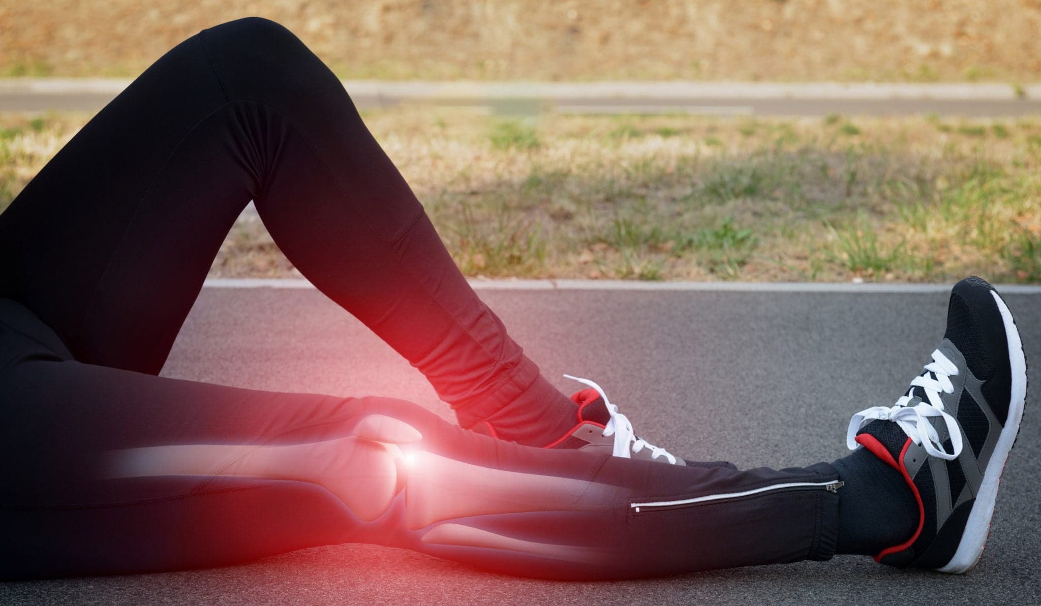 Runner knee injury and pain with leg bones visible