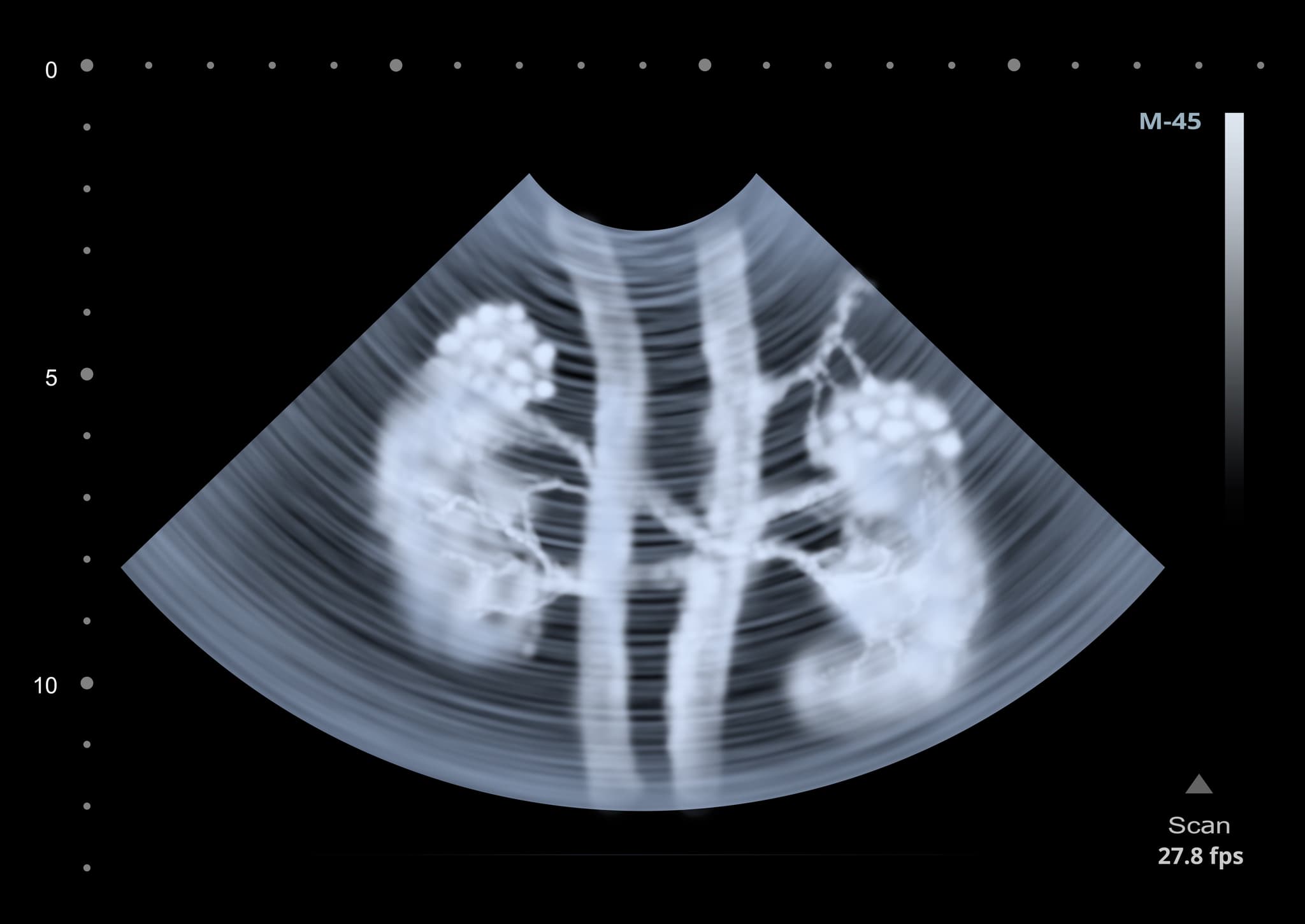 Ultrasound scan of human kidneys. Illustration