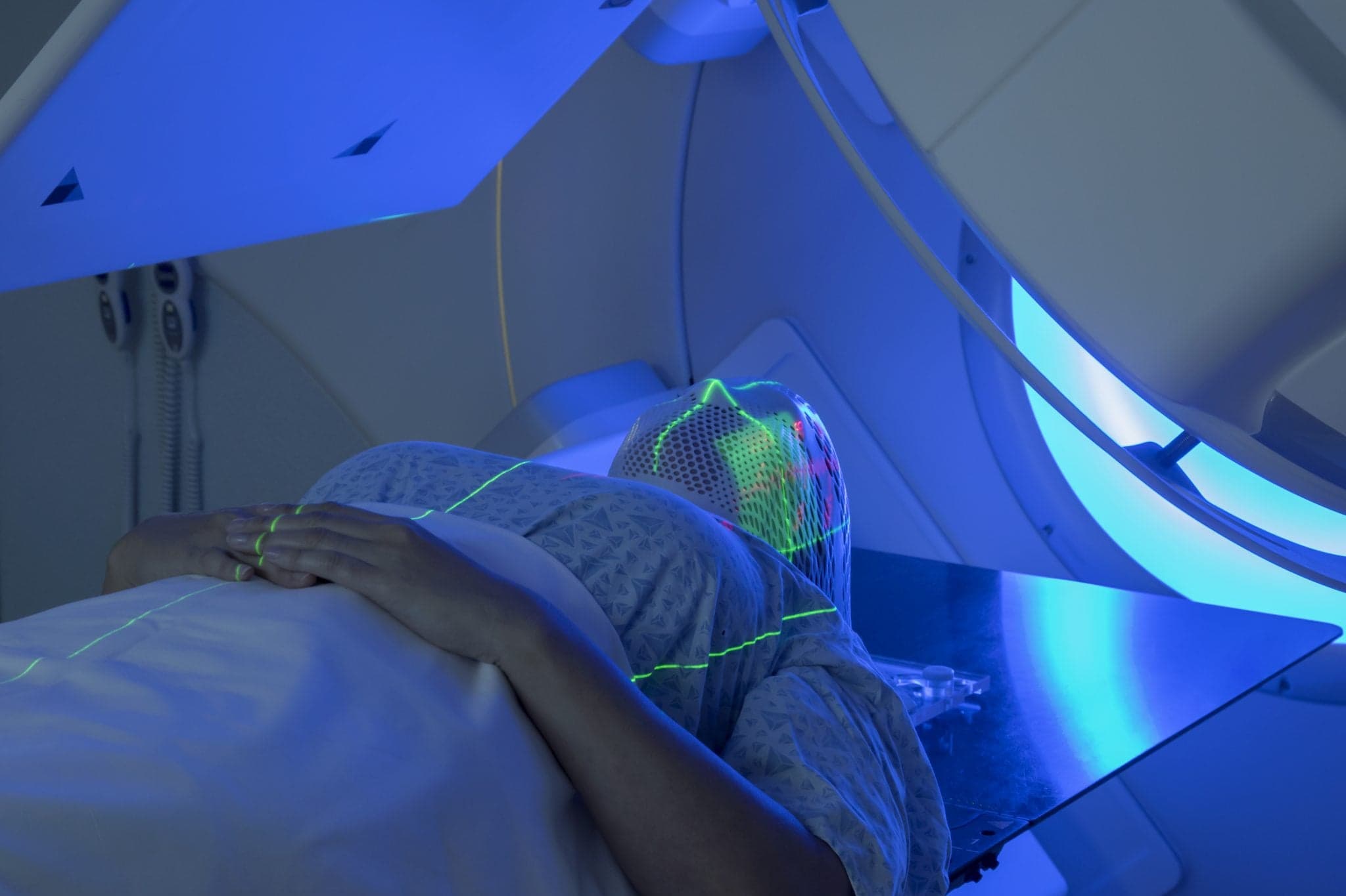 Woman Receiving Radiation Therapy Treatments for Head
