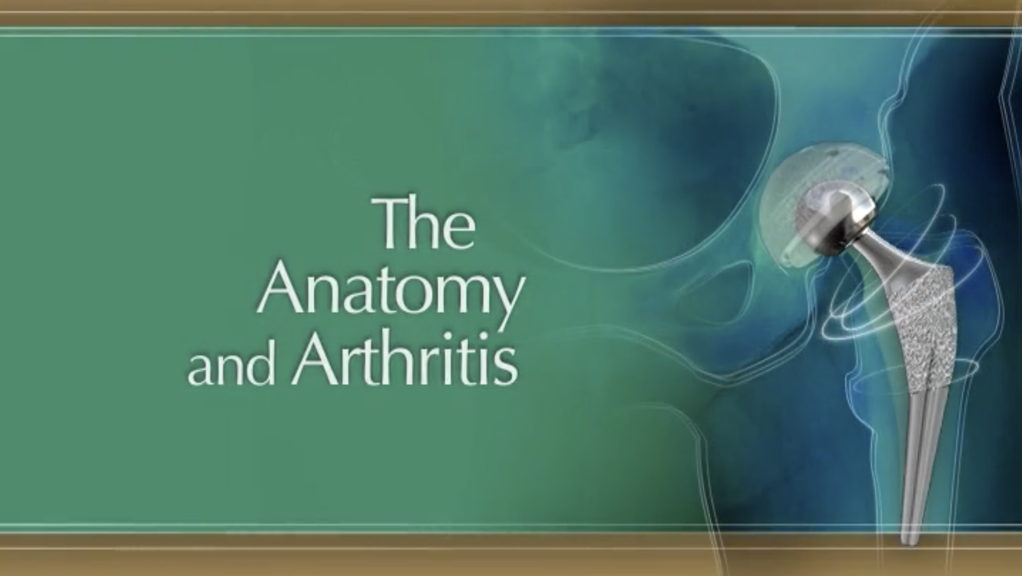 The Anatomy and Arthritis - Hip