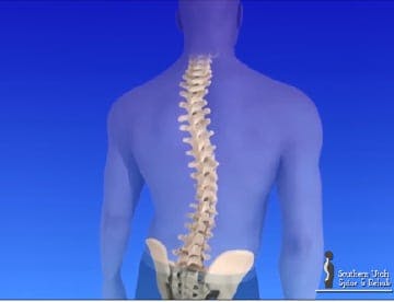 Is Scoliosis Treatable Without Surgery? 